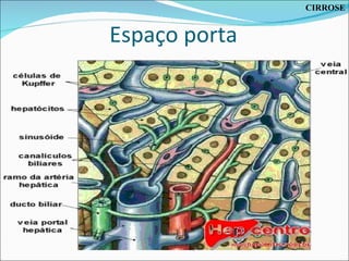 Espaço porta CIRROSE 