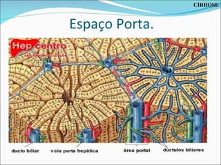 Espaço Porta. CIRROSE 