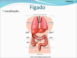 Fígado Localização. CIRROSE Fonte: www.catalog.nucleusinc.com 