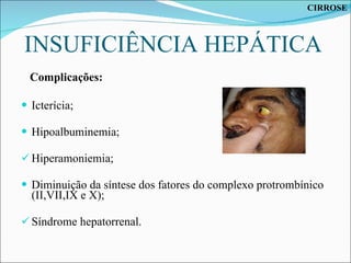 INSUFICIÊNCIA HEPÁTICA Complicações: Icterícia; Hipoalbuminemia; Hiperamoniemia; Diminuição da síntese dos fatores do complexo protrombínico (II,VII,IX e X); Síndrome hepatorrenal. CIRROSE 