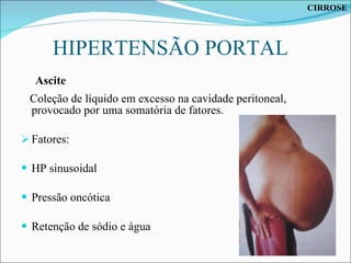 HIPERTENSÃO PORTAL  Coleção de líquido em excesso na cavidade peritoneal, provocado por uma somatória de fatores. Fatores: HP sinusoidal Pressão oncótica Retenção de sódio e água Ascite  CIRROSE 