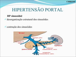 HIPERTENSÃO PORTAL  HP sinusoidal  desorganização estrutural dos sinusóides  contração dos sinusóides CIRROSE 