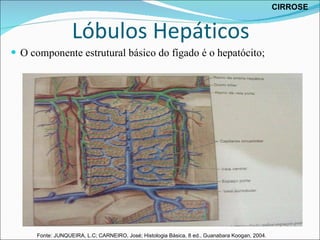 Lóbulos   Hepáticos O componente estrutural básico do fígado é o hepatócito; CIRROSE Fonte: JUNQUEIRA, L.C; CARNEIRO, José; Histologia Básica, 8 ed., Guanabara Koogan, 2004. 