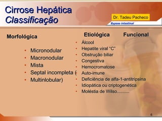 Morfológica Micronodular Macronodular Mista Septal incompleta ( Multinlobular) Etiológica  Funcional Álcool Hepatite viral “C” Obstrução biliar Congestiva Hemocromatose Auto-imune Deficiência de alfa-1-antitripsina Idiopática ou criptogenética Moléstia de Wilso.......... Cirrose Hepática Classificação 