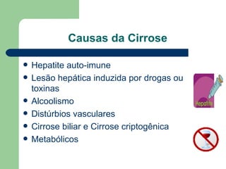 Causas da Cirrose Hepatite auto-imune Lesão hepática induzida por drogas ou toxinas Alcoolismo Distúrbios vasculares Cirrose biliar e Cirrose criptogênica Metabólicos 