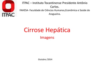 ITPAC – Instituto Tocantinense Presidente Antônio 
Carlos. 
FAHESA- Faculdade de Ciências Humanas,Econômica e Saúde de 
Araguaína. 
Cirrose Hepática 
Imagens 
Outubro /2014 
 