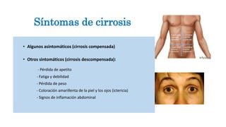 • Algunos asintomáticos (cirrosis compensada)
• Otros sintomáticos (cirrosis descompensada):
- Pérdida de apetito
- Fatiga y debilidad
- Pérdida de peso
- Coloración amarillenta de la piel y los ojos (ictericia)
- Signos de inflamación abdominal
Síntomas de cirrosis
 