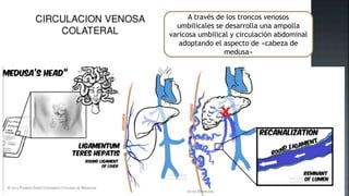 A través de los troncos venosos
umbilicales se desarrolla una ampolla
varicosa umbilical y circulación abdominal
adoptando el aspecto de «cabeza de
medusa»
 