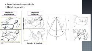 Percusión en forma radiada
 Matidez en ascitis
 