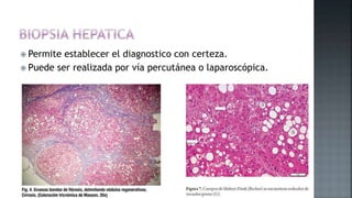  Permite establecer el diagnostico con certeza.
 Puede ser realizada por vía percutánea o laparoscópica.
 