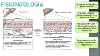 Activación de las células
perisinusoidales
Sintetizan colágeno I y
III que se deposita en el
espacio de Disse
Provocan obstrucción y
alteran el intercambio
entre el plasma y los
hepatocitos
Generando una amplia
fibrosis y nódulos de
regeneración
 