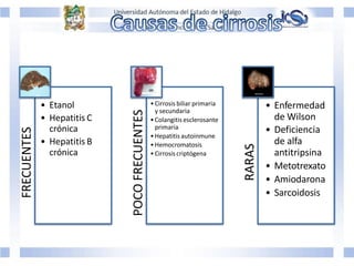 FRECUENTES
• Etanol
• Hepatitis C
crónica
• Hepatitis B
crónica
POCO
FRECUENTES
•Cirrosis biliar primaria
y secundaria
•Colangitis esclerosante
primaria
•Hepatitis autoinmune
•Hemocromatosis
•Cirrosiscriptógena
RARAS
• Enfermedad
de Wilson
• Deficiencia
de alfa
antitripsina
• Metotrexato
• Amiodarona
• Sarcoidosis
 