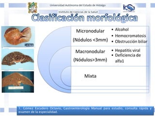Micronodular • Alcohol
• Hemocromatosis
(Nódulos <3mm) • Obstrucción biliar
Macronodular • Hepatitis viral
• Deficiencia de
(Nódulos>3mm) alfa1
Mixta
1. Gómez Escudero Octavio, Gastroenterología Manual para estudio, consulta rápida y
examen de la especialidad.
 