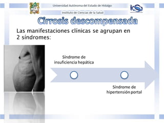 Las manifestaciones clínicas se agrupan en
2 síndromes:
Síndrome de
insuficiencia hepática
Síndrome de
hipertensión portal
 