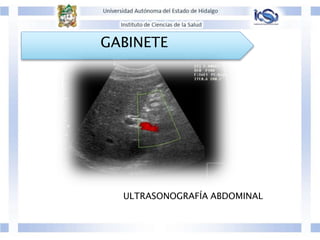 GABINETE
ULTRASONOGRAFÍA ABDOMINAL
 