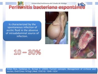 Gines Pere, Cardenas A., Arroyo V. (2004), Current concepts: Management of cirrhosis and
ascites, Ovid Gines: N Engl J Med; 350(16): 1646-1654
Is characterized by the
spontaneous infection of
ascitic fluid in the absense
of intraabdominal source of
infection.
 