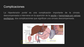 Complicaciones
La Hipertensión portal es una complicación importante de la cirrosis
descompensada e interviene en la aparición de la ascitis y hemorragia por varices
esofágicas, dos complicaciones que significan una cirrosis descompensada.
 