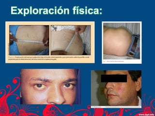 Exploración física:
 