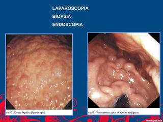 LAPAROSCOPIA
BIOPSIA
ENDOSCOPIA
 