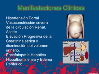 Hipertensión Portal
Vasoconstricción severa
de la circulación Renal.
Ascitis
Elevación Progresiva de la
Creatinina sérica y
disminución del volumen
urinario.
Encefalopatía Hepática
Hipoalbuminemia y Edema
Periférico
Manifestaciones Clínicas
 