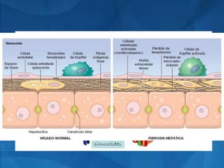 PATOGENIA AGENTE
AGRESIVO
Inflamación
necrosis de los
hepatocitos
Cicatrización
fibrosa
alteración
cordones
celulares
Y vasos
sanguíneos
Formación de
nódulos
regenativos
CIRROSIS
1
2
34
5
6
Bibliografía
•Harrison 17ava edición, capitulo 14, pag.2592
•http://apps.elsevier.es/watermark/ctl_servlet?_f=10&pi
dent_articulo=90150227&pident_usuario=0&pcontactid
=&pident_revista=3&ty=53&accion=L&origen=zonadel
ectura&web=www.elsevier.es&lan=es&fichero=3v26n0
4a90150227pdf001.pdf
 