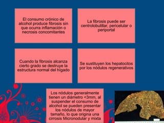 El consumo crónico de
alcohol produce fibrosis sin
que ocurra inflamación o
necrosis concomitantes
La fibrosis puede ser
centrolobulillar, pericelular o
periportal
Cuando la fibrosis alcanza
cierto grado se destruye la
estructura normal del hígado
Se sustituyen los hepatocitos
por los nódulos regenerativos
Los nódulos generalmente
tienen un diámetro <3mm, al
suspender el consumo de
alcohol se pueden presentar
los nódulos de mayor
tamaño, lo que origina una
cirrosis Micronodular y mixta
 