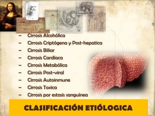 CLASIFICACIÓN ETIÓLOGICA
– Cirrosis Alcohólica
– Cirrosis Criptógena y Post-hepatica
– Cirrosis Biliar
– Cirrosis Cardíaca
– Cirrosis Metabólica
– Cirrosis Post-viral
– Cirrosis Autoinmune
– Cirrosis Toxica
– Cirrosis por estasis sanguínea
 