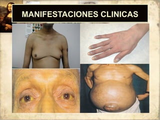 MANIFESTACIONES CLINICAS
 