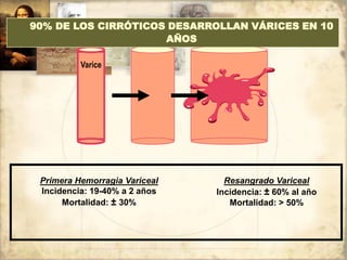 Primera Hemorragia Variceal
Incidencia: 19-40% a 2 años
Mortalidad: ± 30%
Resangrado Variceal
Incidencia: ± 60% al año
Mortalidad: > 50%
Varice
90% DE LOS CIRRÓTICOS DESARROLLAN VÁRICES EN 10
AÑOS
 
