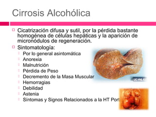 Cirrosis Alcohólica
 Cicatrización difusa y sutil, por la pérdida bastante
homogénea de células hepáticas y la aparición de
micronódulos de regeneración.
 Sintomatología:
 Por lo general asintomática
 Anorexia
 Malnutrición
 Pérdida de Peso
 Decremento de la Masa Muscular
 Hemorragias
 Debilidad
 Astenia
 Síntomas y Signos Relacionados a la HT Portal
 