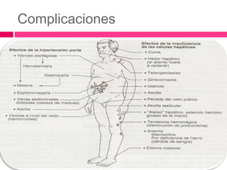 Complicaciones
 
