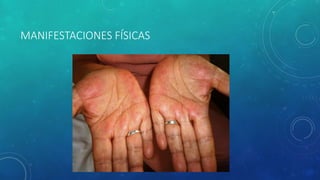 MANIFESTACIONES FÍSICAS