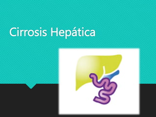 Cirrosis Hepática
 
