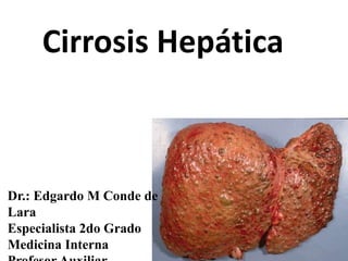 Cirrosis Hepática
Dr.: Edgardo M Conde de
Lara
Especialista 2do Grado
Medicina Interna
 