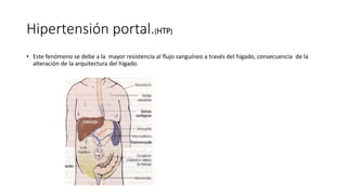Hipertensión portal.(HTP)
• Este fenómeno se debe a la mayor resistencia al flujo sanguíneo a través del hígado, consecuencia de la
alteración de la arquitectura del hígado.
 