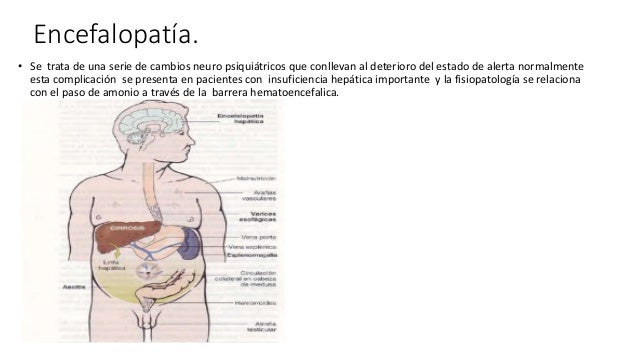 Si dejo a beber cerveza esto
