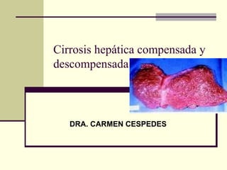 Cirrosis hepática compensada y
descompensada

DRA. CARMEN CESPEDES

 