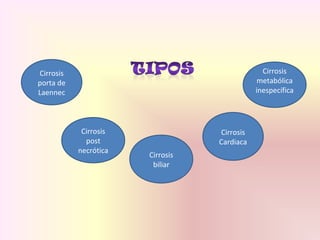 Cirrosis
metabólica
inespecífica
Cirrosis
Cardiaca
Cirrosis
post
necrótica
Cirrosis
porta de
Laennec
Cirrosis
biliar
 