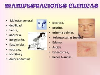 • Malestar general,
• debilidad,
• fiebre,
• anorexia,
• indigestión,
• flatulencias,
• nauseas,
• vómitos y
• dolor abdominal.
• Ictericia,
• prurito,
• eritema palmar,
• telangectasias (nevus)
• Edema,
• Ascitis
• Esteatorrea,
• heces blandas.
 