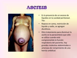 • Es la presencia de un exceso de
líquidos en la cavidad peritoneal.
Tto:
• Reposo en cama, restricción de
liquido y sodio, se agregan
diuréticos.
• Otro tratamiento para disminuir la
ascitis es la paracentesis que sólo
se utiliza cuando está
comprometida la función
respiratoria del paciente, hay
grandes molestias abdominales o
amenaza de rompimiento de una
hernia umbilical.
 