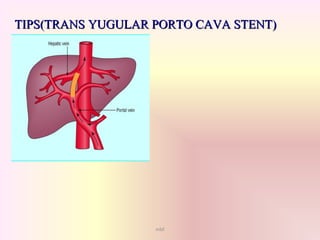 mbf
TIPS(TRANS YUGULAR PORTO CAVA STENT)TIPS(TRANS YUGULAR PORTO CAVA STENT)
 