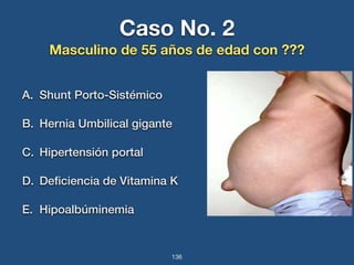 Caso No. 2 
Masculino de 55 años de edad con ??? 
A. Shunt Porto-Sistémico 
B. Hernia Umbilical gigante 
C. Hipertensión portal 
D. Deficiencia de Vitamina K 
E. Hipoalbúminemia 
136 
 