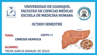 UNIVERSIDAD DE GUAYAQUIL
FACULTAD DE CIENCIAS MÉDICAS
ESCUELA DE MEDICINA HUMANA
OCTAVO SEMESTRE
GRUPO #2TEMA:
CIRROSIS HEPATICA
ALUMNO:
TROYA GARCIA MANUEL DE JESUS
 