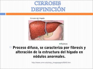    Proceso difuso, se caracteriza por fibrosis y
     alteración de la estructura del hígado en
                nódulos a...