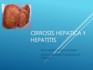 CIRROSIS HEPATICA Y
HEPATITIS
ROSA MARIA RAMOS GUZMAN
MEDICO RESIDENTE MEDICINA DE
FAMILIA
 