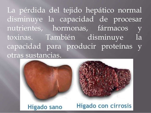 El tratamiento contra el alcoholismo por el curandero