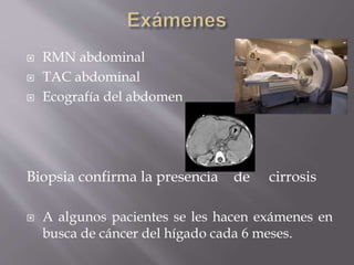  RMN abdominal
 TAC abdominal
 Ecografía del abdomen
Biopsia confirma la presencia de cirrosis
 A algunos pacientes se les hacen exámenes en
busca de cáncer del hígado cada 6 meses.
 