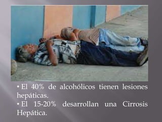 • El 40% de alcohólicos tienen lesiones
hepáticas.
• El 15-20% desarrollan una Cirrosis
Hepática.
 