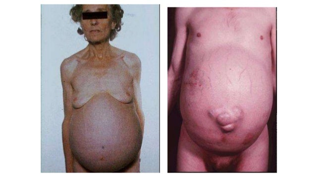 Postura Descerebracion Pdf Postura Descerebracion Pdf