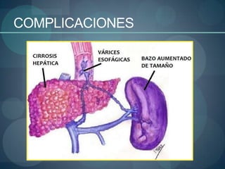 COMPLICACIONES
 